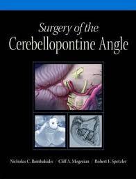 Surgery of the Cerebellopontine Angle - نورولوژی
